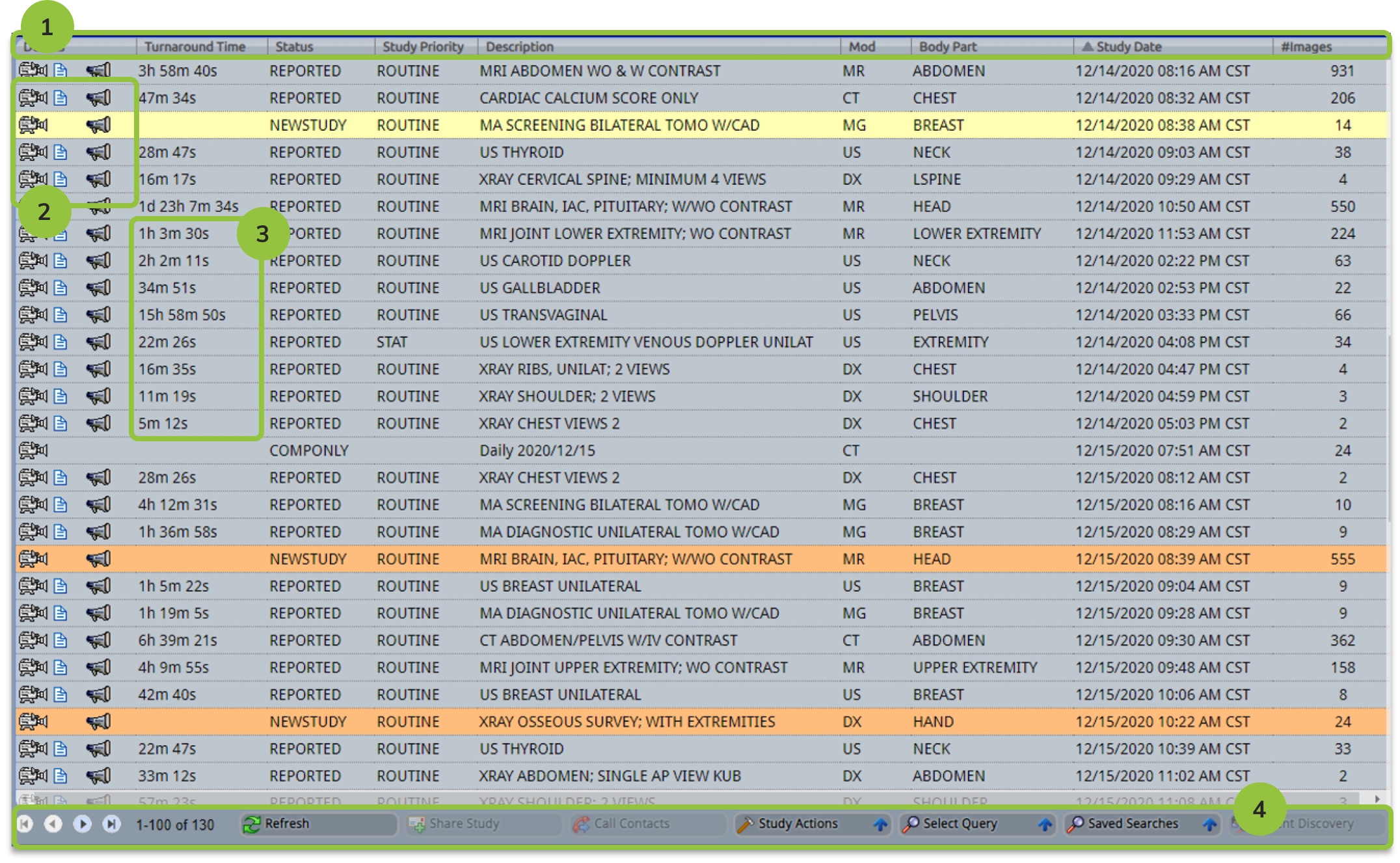 BRIT system worklist