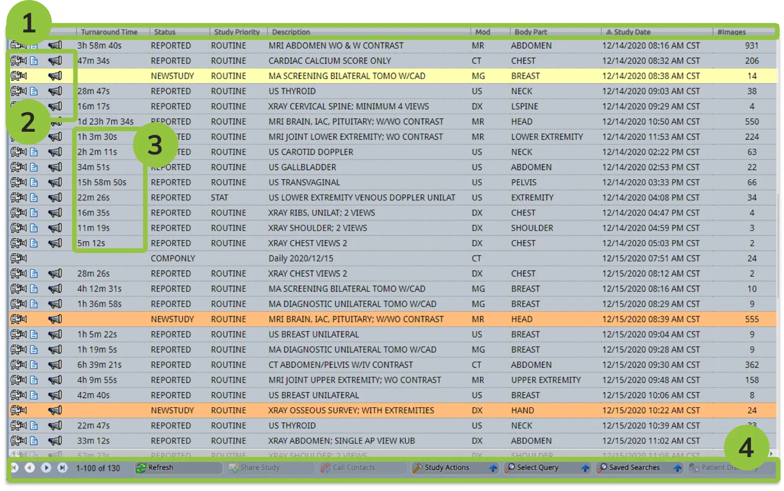 BRIT system worklist